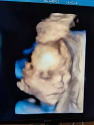 -重庆安琪儿妇产医院-妇幼保健联盟医院