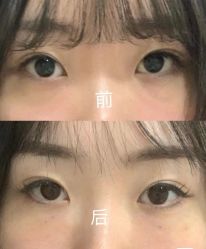 -郡艺医疗美容·微整·眼鼻吸脂