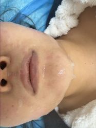 -长沙雅美医疗美容医院
