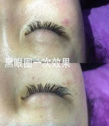 -晶奕空间专业脱毛连锁机构