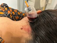-名医堂永康中医·推拿正骨·针灸·艾灸