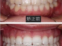 -团圆口腔·种植中心(锦江院区)