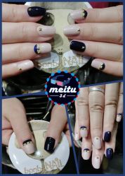 iphone_upload_pic-光SPA科技美肤