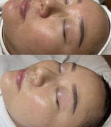 -悦瑢港湾科技美肤芳疗美容