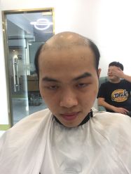 -发饰美男士增发补发假发定制店