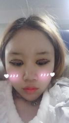 点击看大图 -成都西区医院整形美容