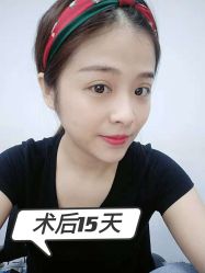 点击看大图 -广州健丽·去眼袋医疗美容机构