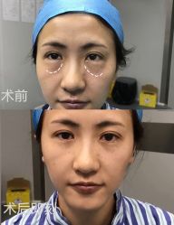 -天津健丽·去眼袋医疗美容机构