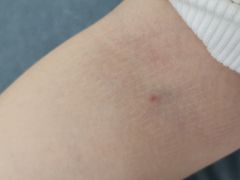 -普惠健康体检中心(西安未央体检中心)