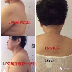 -克丽缇娜