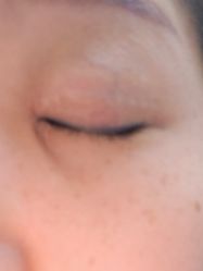 -成都军建医院·疤痕诊疗中心