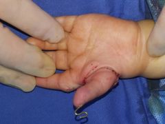 -华中科技大学同济医学院附属协和医院(主院区)