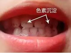-团圆口腔·种植中心(锦江院区)