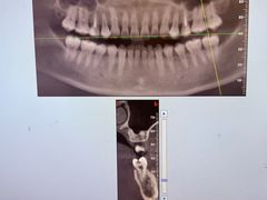 -泰康拜博口腔医院(海曙店)