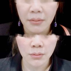 -洁铭新加坡医美