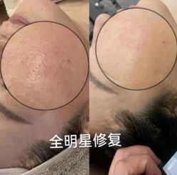 -LUNA皮相美·骨相美高级美感