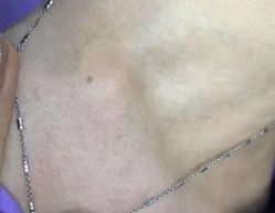 -悦己医疗美容整形线雕提升专门店