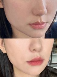 -上海伊莱美医疗美容医院