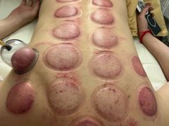 -蓉城阳光推拿馆(羊子山路店)