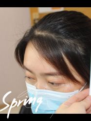 点击看大图 -大麦微针植发全国连锁