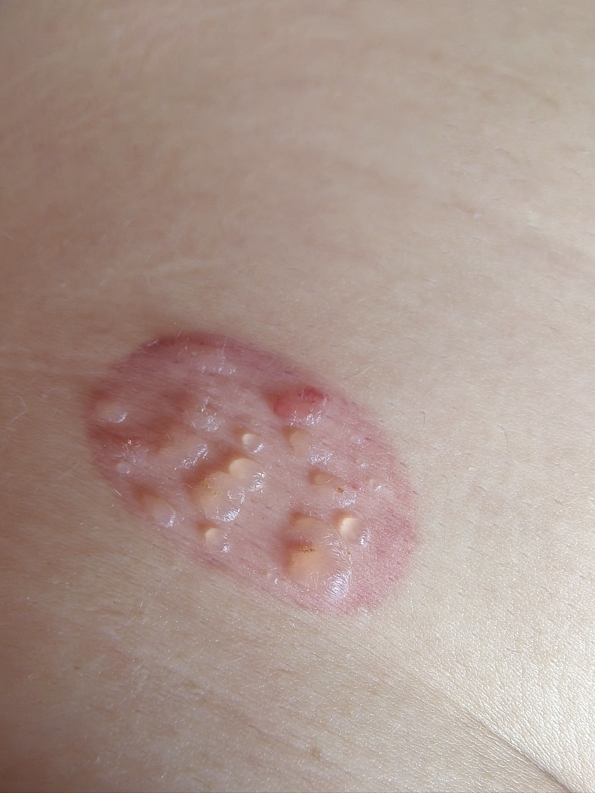 湿气重的女人一定要这样