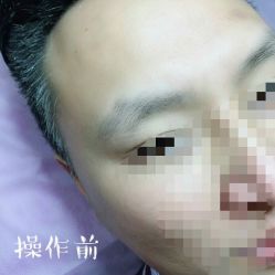 -西施无菌半永久纹绣眉眼影唇轻增发纹发际线