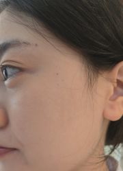 -长沙雅美医疗美容医院