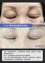 点击看大图 -丰联丽格医疗美容·联合丽格眼整形中心