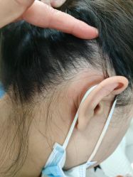 -北京美痣堂古方祛痣斑疣瘊