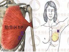 -通透堂中医·精准推拿(旗舰店)