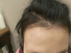 体验后-四川米兰柏羽医学美容医院