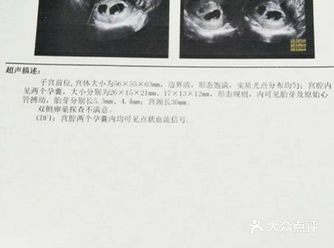 孕期b超单怎么看，医生一分钟教你看懂
