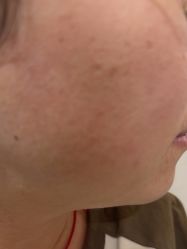 -安徽合肥韩美整形外科医院