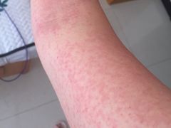 -龙达温泉生态城