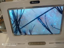 -碧莲盛·不剃发植发