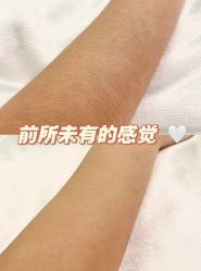 -薇兰专业脱毛连锁机构