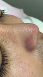 -苑苑vbeauty科技美容SPA