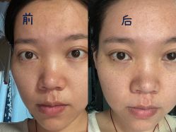 体验前-西安壹加壹医疗美容·西北抗衰旗舰店