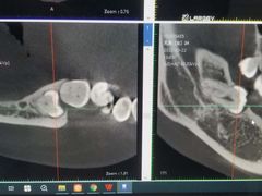 -Dr.Z dental仁康种植矫正中心