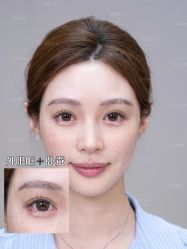 -深圳艺星医疗美容医院