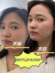 -伊丽莎白医疗美容