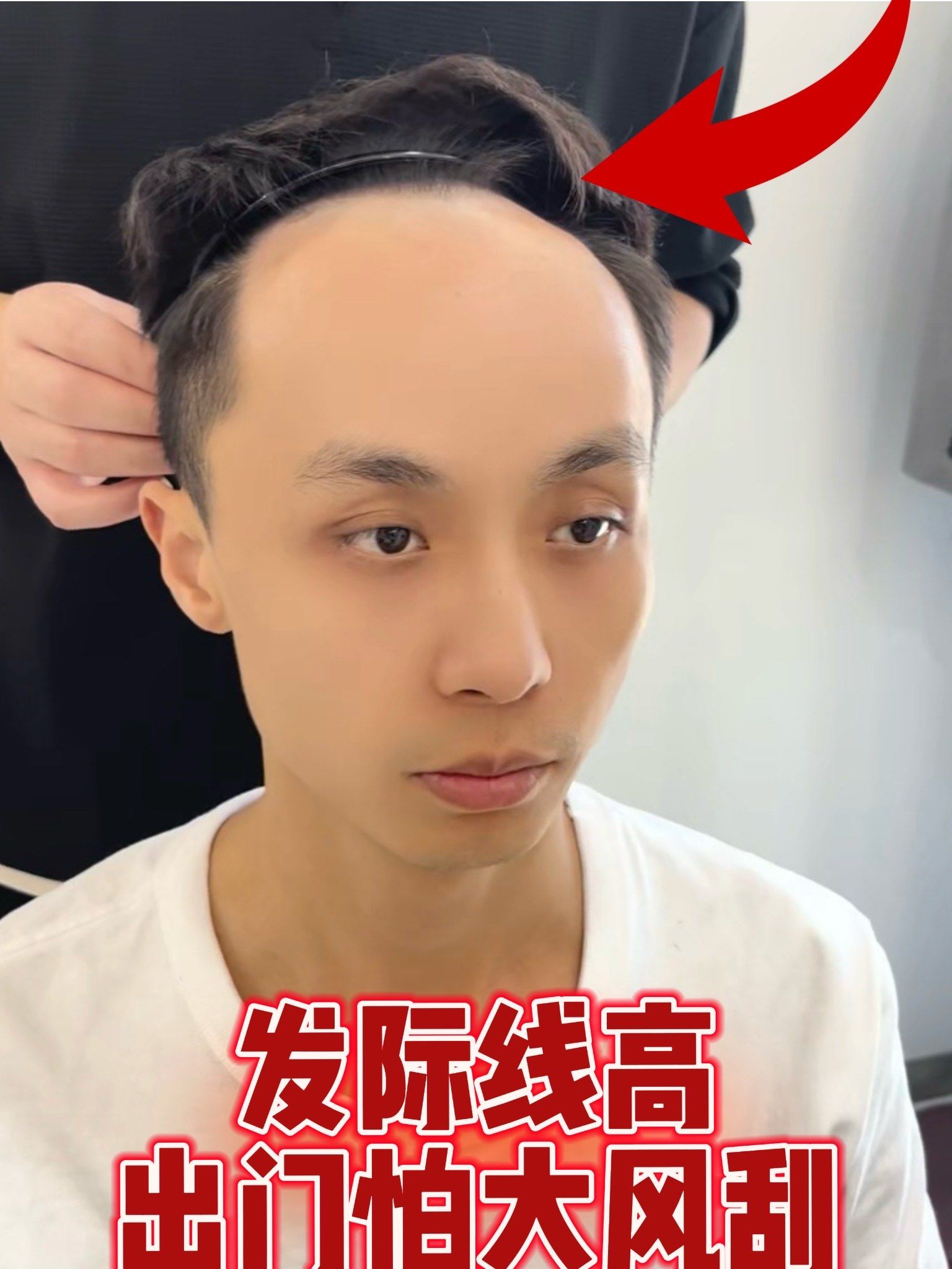 发际线高的帅哥没问们看过来