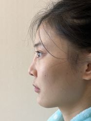 -北京米扬丽格医疗美容·联合丽格鼻整形中心