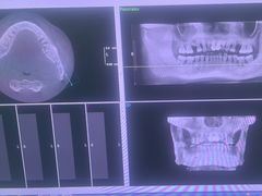 -土豆口腔(凤凰北总店)