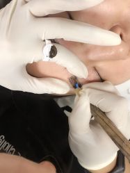 -babiline芭比莱恩半永久纹眉纹唇发际线