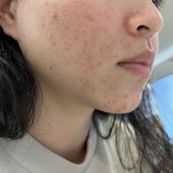 体验后-深圳阳光医疗美容医院·旗舰店