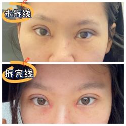 -素美医疗美容·西南眼鼻整形·修复基地