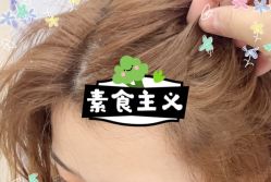 -大麦微针植发全国连锁