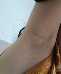 -杭州米兰柏羽医疗美容医院