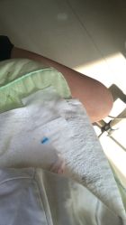 -苗颜坊专业祛痘全国连锁机构